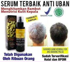 Our hair is exposed to the sun and pollution every single day. Anti Uban Posts Facebook