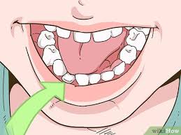 4 Formas De Sacar Un Diente De Leche Flojo Sin Dolor