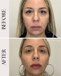 Edgebrook Dermatology: Medical, Laser & Aesthetic Center