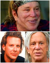 Some celebrities faced career setbacks after undergoing plastic surgery  that drew more attention than their talent. Meg Ryan, once America's  sweetheart, experienced criticism for her altered looks, while Lara Flynn  Boyle and