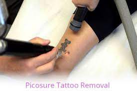If you don't want to take your tattoos all the way off, you can simply lighten them enough to get some good cover. Elite Laser Advanced Laser Tattoo Removal And Skin Therapy Clinic