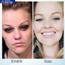 HOT]Kem Cai Thuốc Lá Kanye HB