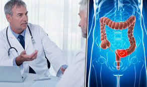 Discover 10 common bowel cancer symptoms at 10faq health and stay better informed to make cancer of certain internal organs is particularly difficult to recover from. Colorectal Cancer Symptoms Include Cramps But Scientists Find Cure Express Co Uk