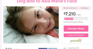 Girl recovering after dog bite