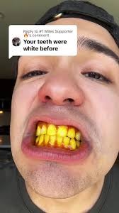 What Happens If You Get Toothpaste in Your Eye