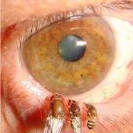 Drosophilids at human eye in Thailand. Three fruit flies... | Download Scientific Diagram