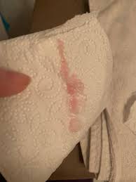 Check spelling or type a new query. Implantation Bleeding Or Miscarriage Hot Topics Forums What To Expect