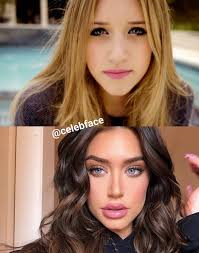 Taylor swift cosmetic surgery like all celebs trigger excellent passion in lots of people! What Do Ig Accounts Like Celebface Get Out Of Exposing Celebrity Surgery Dazed Beauty