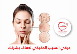 للحصول على البشرة الملساء والنديّة التي تحلمين بها عليكي الاعتناء ببشرتك من  الداخل والخارج . وللعناية الداخلية بصحة بشرتك (سمارت لاب ) يقدم لكي مجموعة  من الفحوصات الطبية التي يجب إجراءها لمعرفة