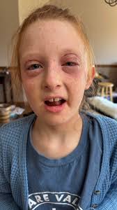 Prayers for Lydia's Recovery at Riley Pediatric Rehab Hospital