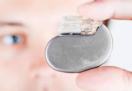 If you or your loved one had or has a potentially defective icd or pacemaker. Pacemakers And Defibrillators Save Lives In Different Ways Health Essentials From Cleveland Clinic