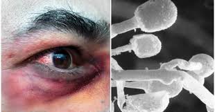 Enquanto, cladophialophora sp detectada, algumas vezes, em caranguejos doentes, é considerada uma espécie oportunista. Rm3bjycndjcavm