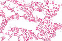 Multistate outbreak of salmonella enteritidis infections linked to ground beef (final update). Salmonella Enteritidis Causes Meat Poisoning Smear Instruments Direct