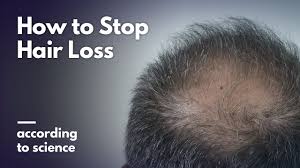 Typically at least the head is involved. How To Cure Baldness According To Science