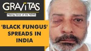 The overprescription of steroids, in particular, to treat. Gravitas What Is Black Fungus Or Mucormycosis Youtube
