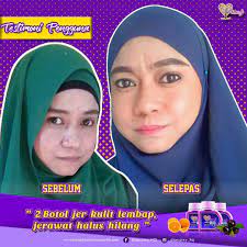 Buy the newest dianz vitamin supplements in malaysia with the latest sales & promotions ★ find cheap offers ★ browse our wide selection dianz vitamin supplements price in malaysia june 2021. Dianz Vitamin 2017 Extra Ascorbic Acid Dan Glutathione Shad Beauty Lifestyle Blogger