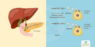 Bertambahnya rasa ingin makan bisa menjadi tanda lain dari diabetes. Diabetes Tanda Dan Gejala Penyebab Cara Mengobati Cara Mencegah