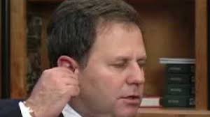 Dr. Salzman Discusses Candidates for a Mini Face Lift