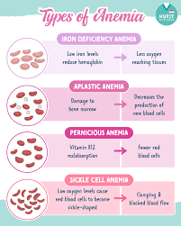 Image result for Anemia