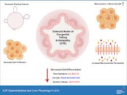 Image result for Intestinal Enteropathy
