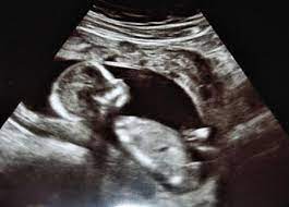 Ya tienes 8 semanas de embarazo, el corazón de tu bebé late fuerte y comienzas a sentir algunos cambios en tu cuerpo. Cinco Grandes Preocupaciones De Las Embarazadas En El Segundo Trimestre Te Sientes Identificada