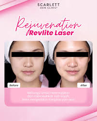 Emang ada yah cewe yang ga suka bunga?🤔 Bunga sendiri melambangkan  kecantikan dan identik sama perempuan. Dari bunga kita bisa buat kreasi  dalam banyak hal, salah satunya adalah merangkai bunga💐 Ada kabar