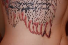 To reduce the risk of a keloid returning after surgical removal, dermatologists often treat patients with. Keloid Scar From Tattoo Removal Tattoo Design