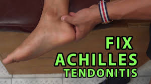 Achilles tendonitis occurs when the tendon that attaches the calf muscles to the heel becomes painful or inflamed. How To Fix Achilles Tendonitis In 4 Minutes Youtube