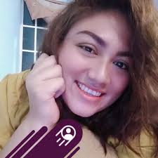 Las líneas de marioneta son los surcos que se forman a través de los años  de las comisuras de los labios hacia el mentón, y podemos rellenarlos con  ácido hialurónico para dar