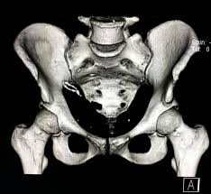 Pin On Ct Scans