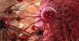 Loại nước "nuôi tế bào UT", 1 ly mỗi ngày nguy cơ UT tăng 90%, nhiều người  Việt uống mỗi ngày👇