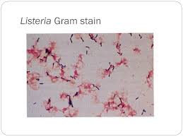 Try our newest study sets that focus on listeria monocytogenes gram stain to increase your studying efficiency and retention. Ppt Listeria Erysipelothrix Powerpoint Presentation Free Download Id 301359