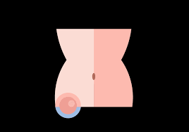 A muscle strain occurs when the muscle is stretched too far. Iwtqn9l14whtrm
