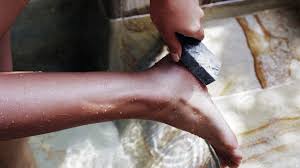 Smelly feet: Footwear tips, home remedies, and more