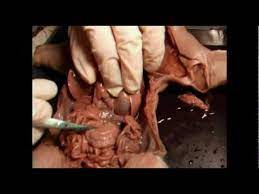 Fetal Pig Dissection Part 5 Circulatory System Youtube