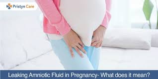 If amniotic fluid begins leaking during pregnancy, this read on to learn more about the purpose of amniotic fluid, normal levels at various stages of pregnancy, and what leakage can indicate. Leaking Amniotic Fluid In Pregnancy What Does It Mean Pristyn Care