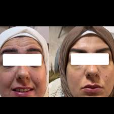 Husseini Dental Clinic (@husseinidentalclinic) • Instagram photos and videos