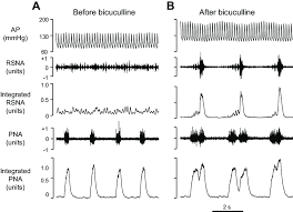 Chart Recording In One Experiment Of Ap Rsna And Pna