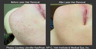 Mladina Prigrizek Zarocena Laser Shaved Blonde Shgraham Com