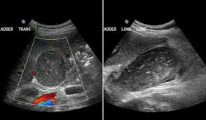 Pin On Us Images Abdomen