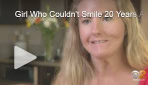 Jenny Whitman, Author at Moebius Syndrome Foundation