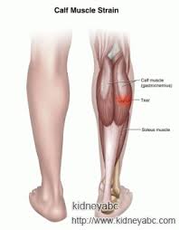 Pin On Kidney Health