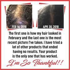 Hair oil such as castor oil, almond we have the best oils for hair development that lift hair development as well as assistance lighten the sparkle, smoothness and general strength of the. Formula D Hair Regrowth Serum Good For Ccca Etsy