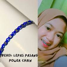 Harga behel lepas pasang power chain murah Terbaru Okt 2025