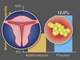 Post Cesarean Infection And Antibiotic Prophylaxis Youtube
