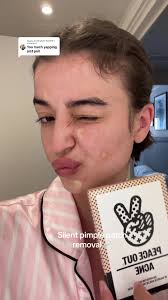 Replying to @NEVAEH BOYER Some more juicy pulls with my favs ✌🏼💋🩹  @PeaceOutSkincare #pimplepatches #peaceoutskincare #pimplepatchremoval  #acnejourney
