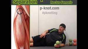 Hip flexor pain & pain when lifting leg can sideline anyone, from everyday folks to star athletes. Got Hip Or Hip Flexor Pain Dull Knee Pain When Walking Downstairs Try This Sunday Separation Youtube