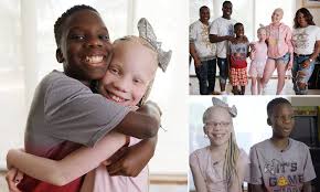 Maybe you would like to learn more about one of these? Black Twins One Albino Pasteurinstituteindia Com