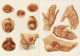 The Sick Rose Disease And The Art Of Medical Illustration Pdf The Sick Rose Or Disease And The Art Of Medical Illustration Amazon Co Uk Richard Barnett 9780500517345 Books
