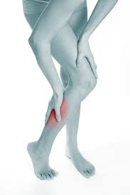 How Compression Stockings Help Relieve Achy Legs Calf Cramps Shin Splints Leg Cramps